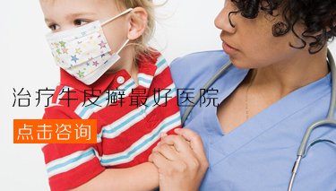 郑州哪家医院治疗儿童牛皮癣最好