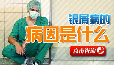 郑州治疗牛皮癣哪家医院效果最好