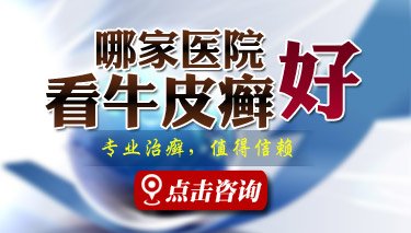 郑州牛皮癣治疗最好医院